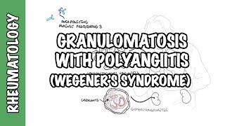 Granulomatosis with Polyangiitis pathophysiology symptoms treatment [upl. by Rocco]