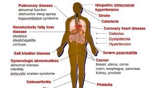 Nutrition Related DiseasesDeath Rates amp Obesity [upl. by Eiuqnom413]