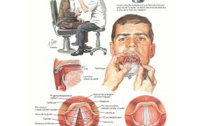 ORL DIAGNOSTIC D’UNE DYSPHONIE [upl. by Zosima756]