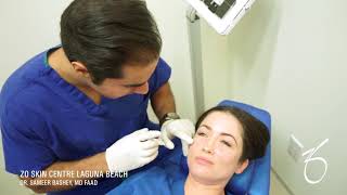 BELOTERO BALANCE® Dermal Filler for Under Eye at ZO Skin Centre [upl. by Pacien]