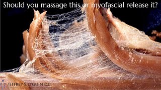 Myofascial release vs massage Chiropractor explains fascia [upl. by Hoebart]