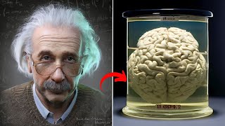 How Albert Einstein Brain was Extraordinary from others [upl. by Nehepts]