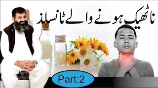 Tonsils Causes amp treatment of Tonsils Infection Homeopathic DRMMUNAWAR DAWOOD [upl. by Hamlen767]