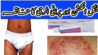 Travocort Cream Uses Benifits and Side Effects In Urdu Used For Fungnal InfectionDr Ijaz Malik [upl. by Enialehs998]