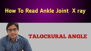 How To Measure TALOCRURAL ANGLE On Ankle X ray [upl. by Norrie394]