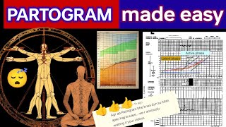 PARTOGRAM ❤️ WHO MODIFIED PARTOGRAM ❤️🙏👍 partogram labour pregnancy mbbs lecture exam [upl. by Oicnerolf517]