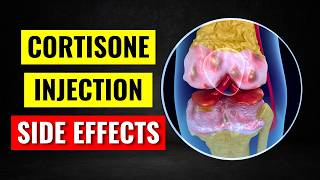 The Single WORST Side Effect of Cortisone Shots [upl. by Hagar]