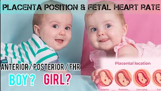 PLACENTA POSITION AND FHR VS BABY GENDER anterior placenta posteriorplacenta boybaby girlbaby [upl. by Fawcett]