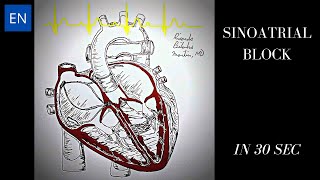 Sinoatrial Block Animation and ECG Shorts [upl. by Car]