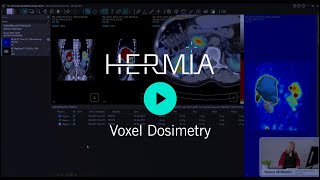 HERMIA Voxel Dosimetry [upl. by Hibbert]