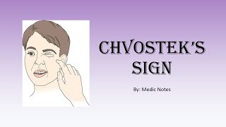 Mechanism of Chvosteks sign explained associated conditions sign value how accurate is it [upl. by Ernest]