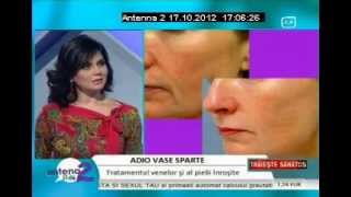 Dr Oana Spanu Cuperoza vase sparte tratament [upl. by Goldenberg]