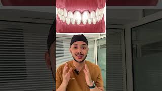 La solution pour le sourire gingival حل الابتسامة اللثوية souriregingivaldentistetanger [upl. by Fidela295]