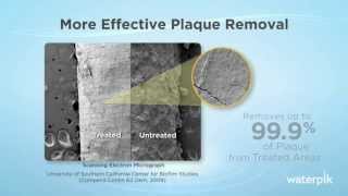 More Effective Plaque Removal  Independent Clinical Study [upl. by Barling]