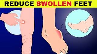 6 Natural Ways To Reduce Swollen Feet amp Ankle FAST That Actually Work [upl. by Savart298]