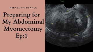 Preparing for my Abdominal Myomectomy Surgery  Fibroid Removal TTC Ep 1 [upl. by Jordana]