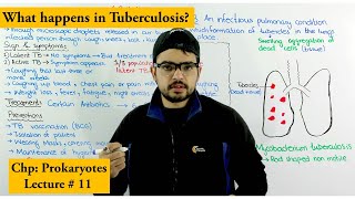 Tuberculosis TB  Causes Treatment Prevention and Transmission [upl. by Conlin]