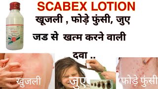 Scabex Lotion Full Information and Preview  शरीर में खुजलीफोडे फुंसीजुए मिटाने की सबसे अच्छी दवा [upl. by Leelah742]