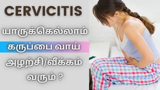 CERVICITIS TREATMENT யாருக்கெல்லாம் கருப்பை வாய் அழற்சிவீக்கம் வரும் [upl. by Aisatsan171]