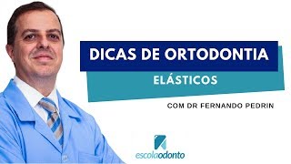 Trecho do curso de Elásticos Ortodônticos [upl. by Buatti]