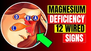 12 Strange Signs Your Body NEEDS Magnesium  HealthQuest [upl. by Tawnya426]