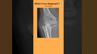 Whats Your Diagnosis 👀radiology radiography doctor nurse medicalstudent medicaltest [upl. by Natalia919]