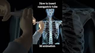 how to insert nasogastric tube for NG intubation shorts humanbody 3danimation medical [upl. by Harbison]