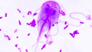 Giardia lamblia  duodenalis  Ogoniastek jelitowy [upl. by Eetnuahs]