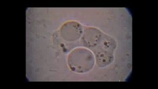 Trichomonas hominis con doble intento de fagocitosis de Blastocystis por un citostoma elástico [upl. by Schurman]