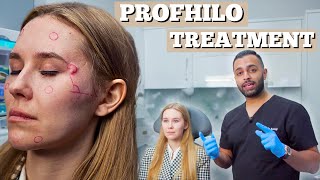 Profhilo Treatment  Dermal Filler For Fine Lines amp Wrinkles  Dr Somji amp Dr Solomon Demonstrate [upl. by Wesley]