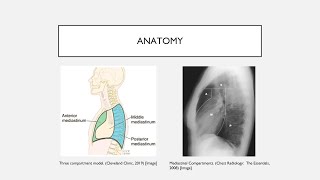 Mediastinal Masses [upl. by Mauricio148]