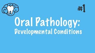 Oral Pathology  Developmental Conditions  INBDE ADAT [upl. by Giordano]