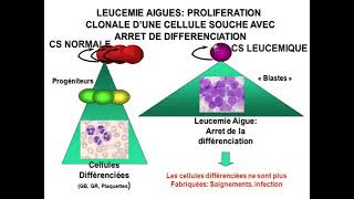 Hemato 12Hémopathies malignes et leucémies aigues Dr Abbadi [upl. by Hadwyn]