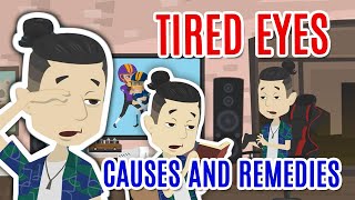 Asthenopia Tired eyes causes and remedies [upl. by Eetsirk]