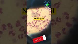 High neutrophil count in peripheral smear  neutrophils  CBC  Causes of Neutrophilia  hematology [upl. by Nnylrefinnej601]