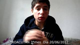 roacutan 3°mes de tratamento [upl. by Ardnnek]