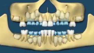 MANTRA TO REGROW TEETH [upl. by Acinoev740]