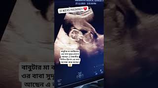 16 Weeks Pregnancy Ultrasonogram  ১৬ সপ্তাহের আলট্রাসোনোগ্রাম কেমন হয় ultrasound pregnancyscan [upl. by Mcclain]