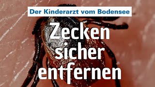 Zecken sicher entfernen – Der Kinderarzt vom Bodensee [upl. by Xylina626]