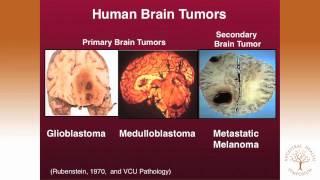 Thomas Seyfried PhD — Targeting Energy Metabolism in Brain Cancer [upl. by Ativoj]