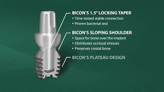 Introduction to Bicon SHORT® Implants HD [upl. by Mell]