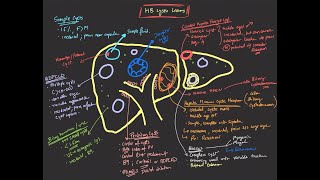 Hepatobiliary cystic lesions [upl. by Ettedranreb]