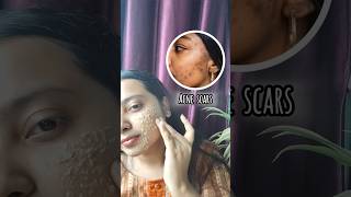 ✨Best facepack for dark spots pigmentation Uneven skin toneLiquorice face packviralshorts [upl. by Nolyar411]