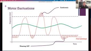 Advanced Therapies Panel Series Apomorphine [upl. by Aninahs]