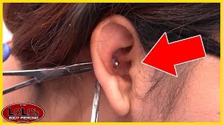 This Conch Piercing Looks BAD Removal [upl. by Fen787]