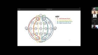 D Rudenko quotIntroduction to the Kaggle competition HMS  Harmful Brain Activity Classificationquot [upl. by Stockton]