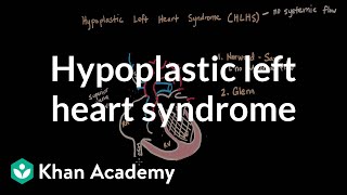 Hypoplastic left heart syndrome and norwood glenn fontan  NCLEXRN  Khan Academy [upl. by Marrilee483]