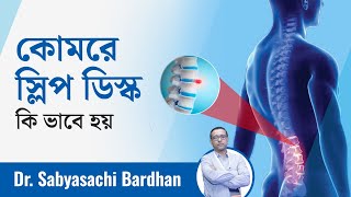 কোমরে স্লিপ ডিস্কের কারণ ও প্রতিকার What is slipped disc back pain Precaution amp treatment  Ep 609 [upl. by Adnohsed]