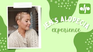 Jens Experience With Alopecia [upl. by Davita]