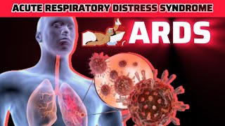 Acute Respiratory Distress Syndrome ARDS  Symptoms  Caused  Risk Factors  Treatment [upl. by Arquit]